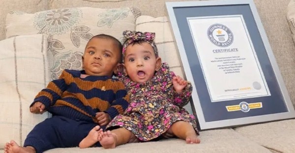 «Шанс на выживание — 0%». Эти близнецы считаются самыми недоношенными в мире